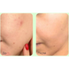 Заспокійлива ампульна сироватка з PDRN та екзосомами MEDIPEEL Young Cica PDRN Trouble Soothing Ampoule, 50 мл 12322 фото 3